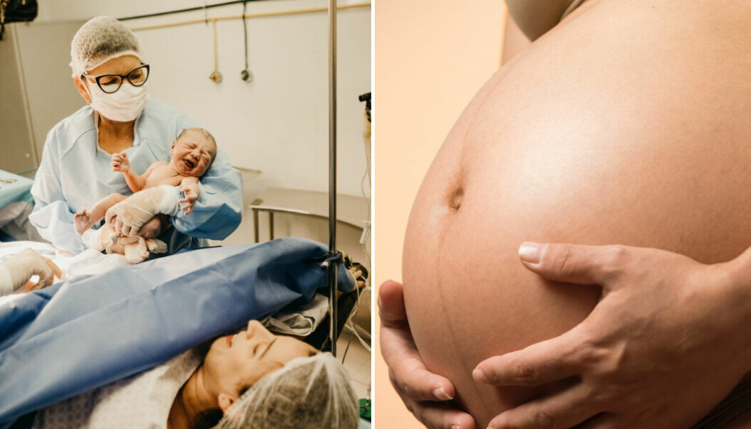 Subventionerad vård, inklusive förlossningsvård, gäller bara om man är folkbokförd i Sverige.