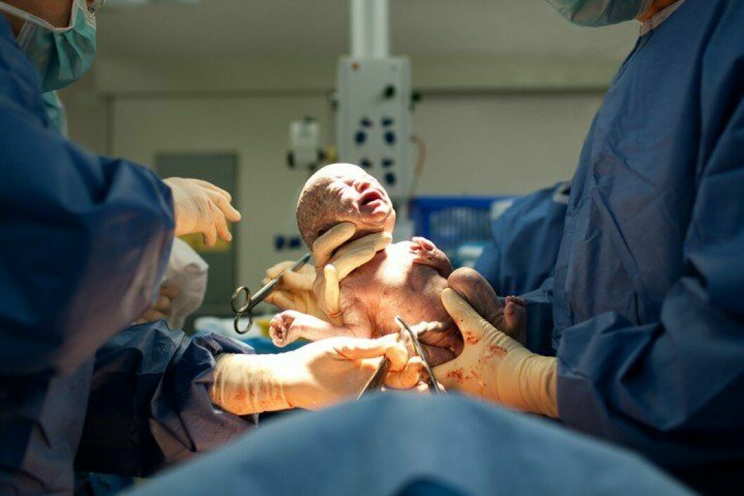 Bebis föds med kejsarsnitt