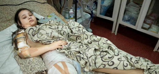 Masha, 15, träffades av granat under promenad – tvingades amputera ben