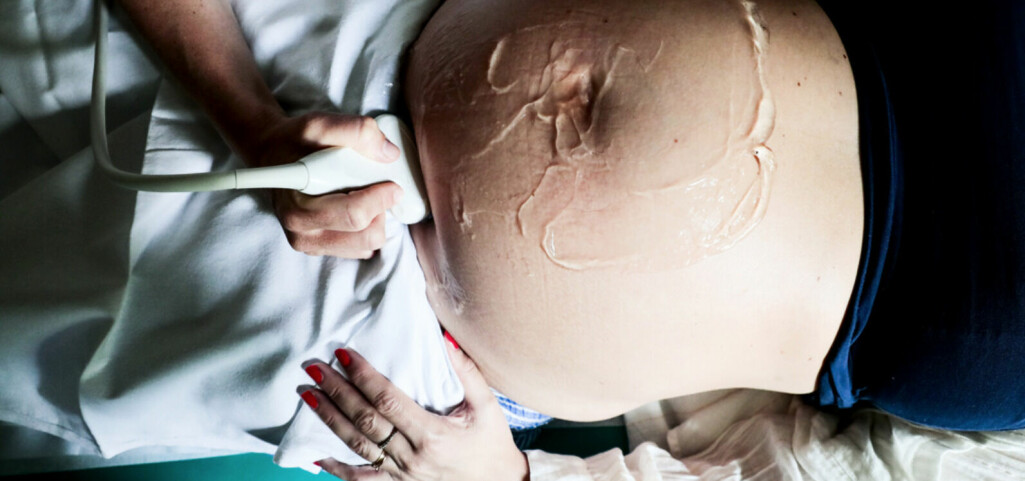 Tvillingar dog före förlossning – vårdgivare får hård kritik