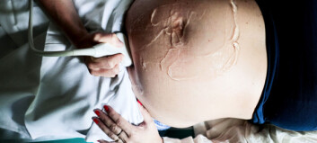 Tvillingar dog före förlossning – vårdgivare får hård kritik